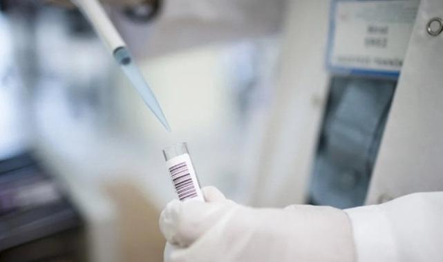 Afrika'da maymun çiçeği alarmı! Kıta genelinde acil durum ilanı