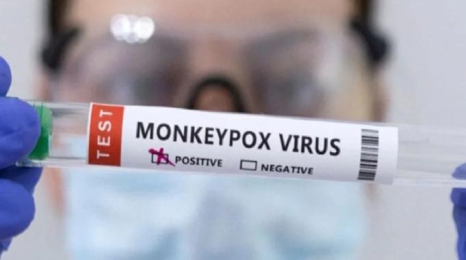 Afrika'da maymun çiçeği alarmı! Kıta genelinde acil durum ilanı