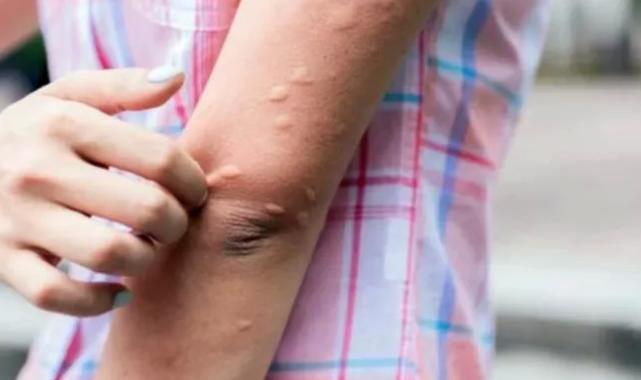 Bursa’da Batı Nil Virüsü tehlikesi büyüyor