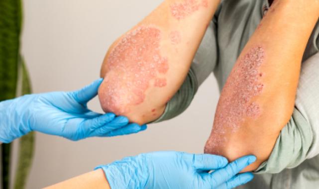 Bursa'da mantar uyarısı