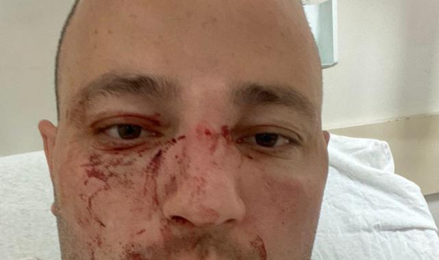 Denizli'de otobüsün farından rahatsız olan şahıs şoförü darbetti