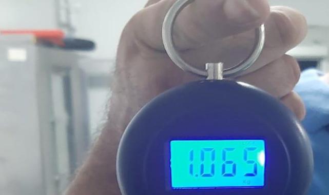 Manisa'da karnı ağrıyan hastanın mesanesinden 1 kilo taş çıktı