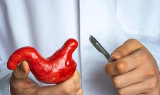 Mide küçültme ameliyatlarındaki ölüm vakaları artıyor