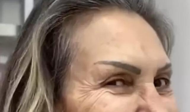 Şarkıcı Petek Dinçöz'ün annesi estetik olmuştu! Doktoru son halini paylaştı