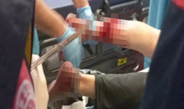 Diyarbakır'da domuz saldırısına uğradı