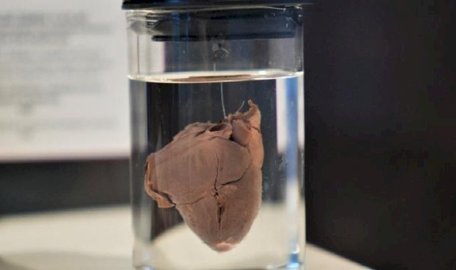 Türkiye'nin 150 yıllık tıp tarihi Samsun'daki müzede: En duygusal köşe 'bebek kalpleri'