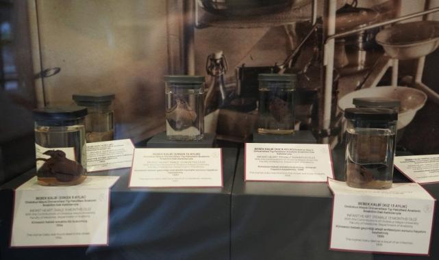 Türkiye'nin 150 yıllık tıp tarihi Samsun'daki müzede: En duygusal köşe 'bebek kalpleri'