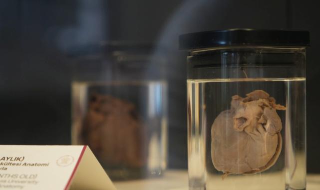 Türkiye'nin 150 yıllık tıp tarihi Samsun'daki müzede: En duygusal köşe 'bebek kalpleri'