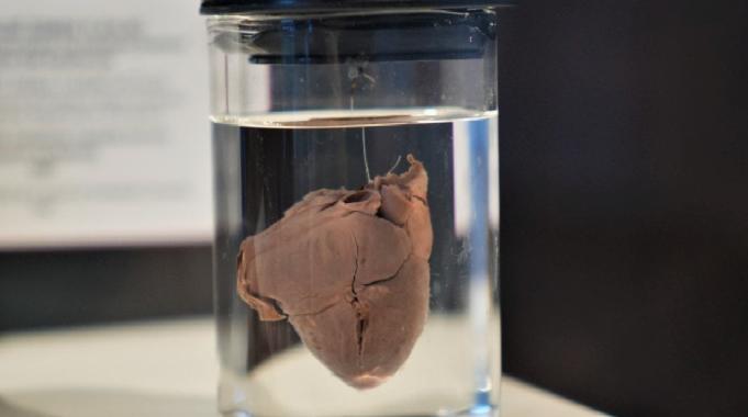 Türkiye'nin 150 yıllık tıp tarihi Samsun'daki müzede: En duygusal köşe 'bebek kalpleri'