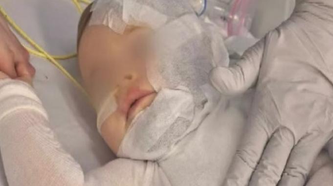 Avustralya&#039;da 9 aylık bebeğin üstüne kahve döküp kaçtı