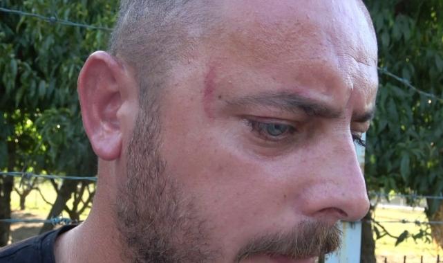 Bursa'da iş görüşmesine çağırdıkları çiftçiye öldüresiyle dövdüler