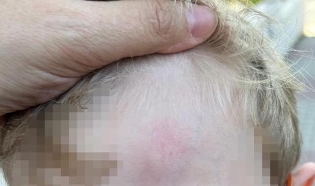 İstanbul'da küçük çocuk öğretmeni tarafından darbedildi