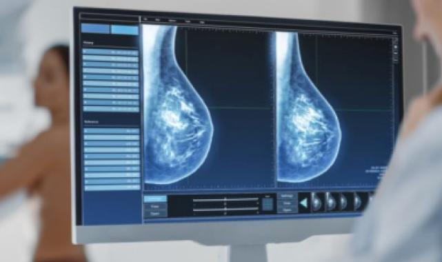 Kötü haber korkusu mamografi taramasına engel!