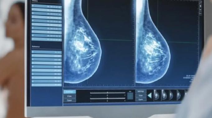 Kötü haber korkusu mamografi taramasına engel!