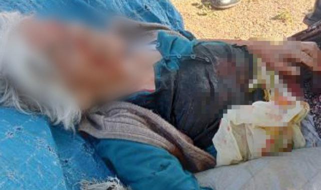 Niğde'de başıboş köpeklerin saldırdığı kadın ağır yaralandı