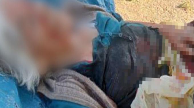 Niğde'de başıboş köpeklerin saldırdığı kadın ağır yaralandı