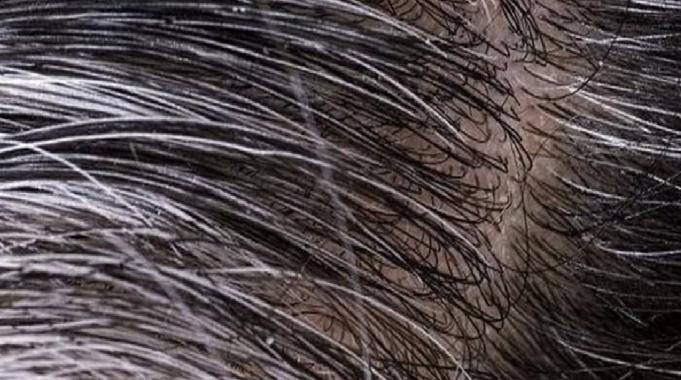 Saç neden beyazlar? İşte 6 nedeni!