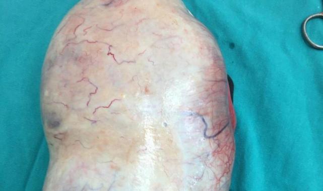 Samsun'da hamile kadının karnından çıkan şaşırttı