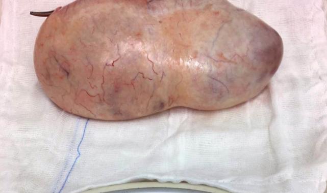 Samsun'da hamile kadının karnından çıkan şaşırttı