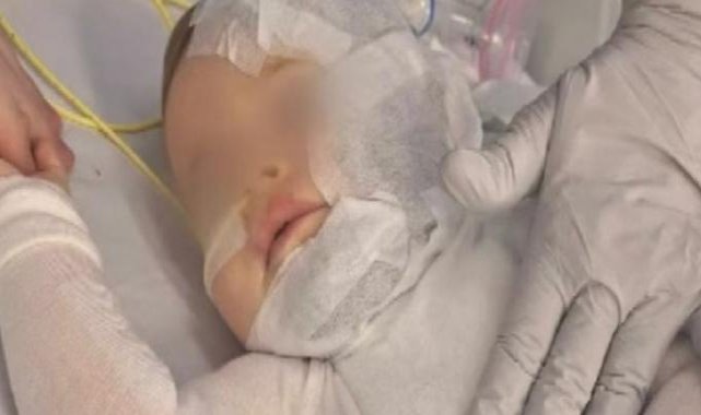 Avustralya'da 9 aylık bebeğin üstüne kahve döküp kaçtı