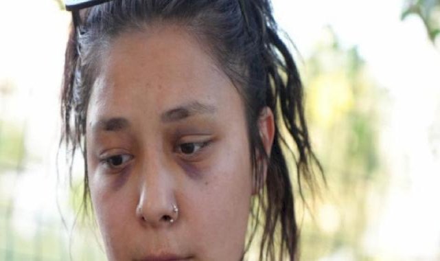 Balıkesir'de tedavi için hastaneye gitti: 'Ölüsünüz' dediler