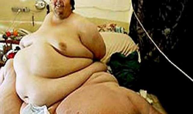 Dünyanın en kilolu insanının ağırlığı şoke edici: Ne 200, ne 300...