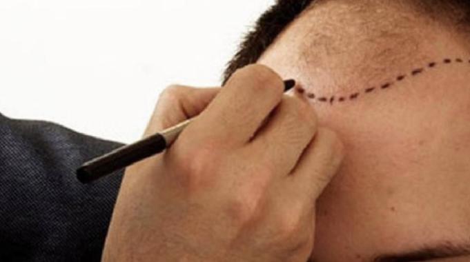 Türkiye sağlık turizminde zirveye yaklaşıyor: Hedef 10 milyar dolar gelir