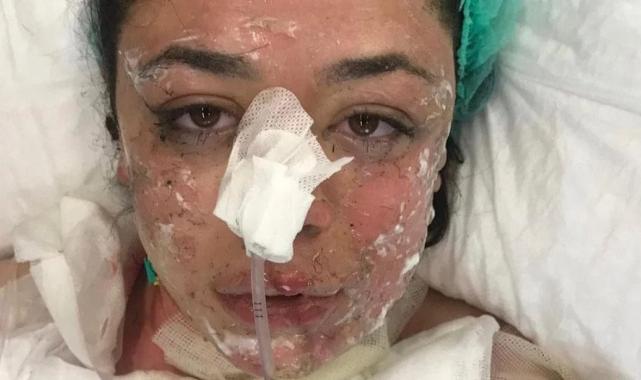 Zonguldak'ta hastane patlamasına ilişkin hemşireden şok açıklama