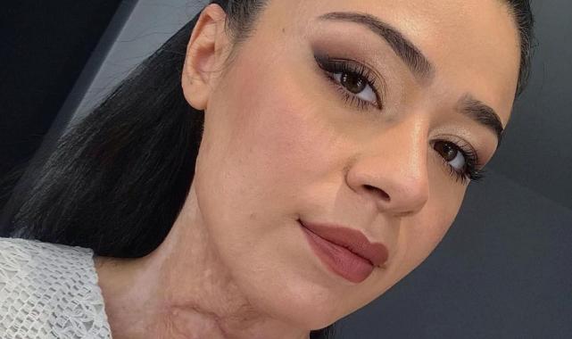 Zonguldak'ta şaka yaparken patlamaya sebep olan hemşirenin cezası belli oldu
