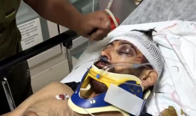 Antalya'da yumruklu saldırıda bilinci kapanan çiçekçinin beyin ölümü gerçekleşti