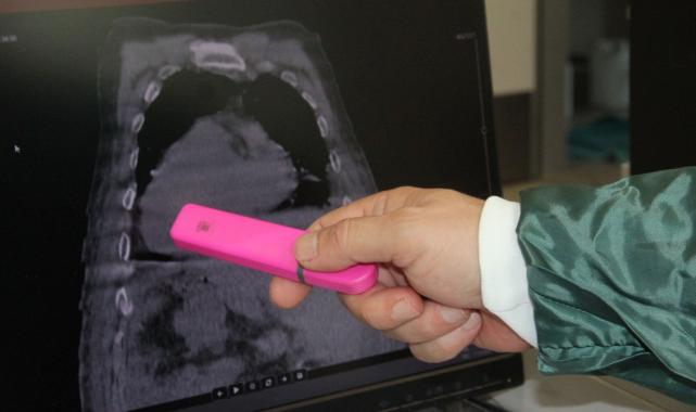 Dünyada ilk olan bir vaka 'Giresun Sendromu' adıyla tıp literatürüne girdi