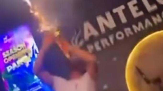 Konya'da şov için klarnetine taktığı konfeti ile kendini yaktı