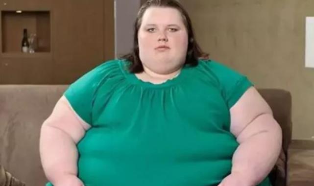 Obezite ameliyatlarından sonra oluşan deri sarkması tedavi edilebilir mi?