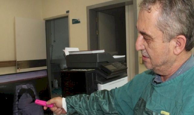 Dünyada ilk olan bir vaka 'Giresun Sendromu' adıyla tıp literatürüne girdi