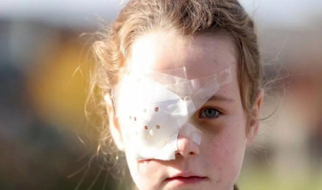 İngiltere'de elektronik sigara 7 yaşındaki çocuğu gözünden etti