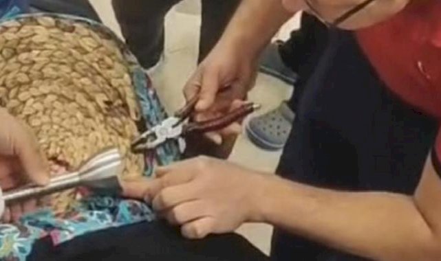 Mersin'de yemek hazırlayan kadının parmağı blendere sıkıştı