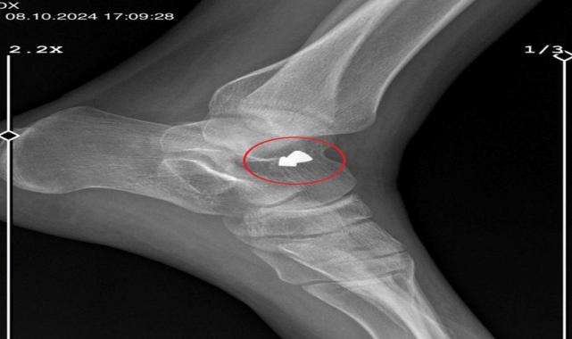 Yalova'da sevgilisinin vurduğu kadın dehşeti yaşadı