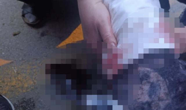 Ankara'da köpekler tarafından yaralanan profesörün mahallesinde insanlar tedirgin