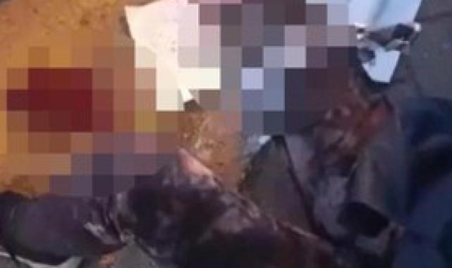 Ankara'da köpeklerin saldırdığı akademisyen: Bu artık insan hakları sorunu