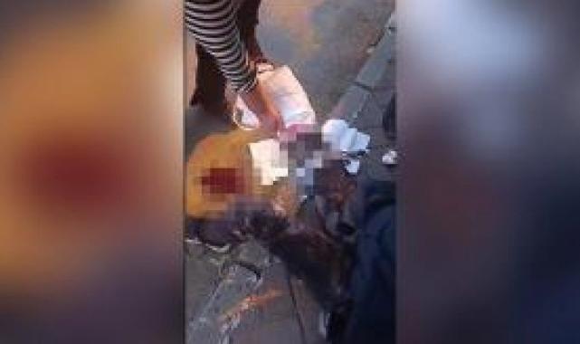 Ankara'da köpeklerin saldırdığı akademisyen: Bu artık insan hakları sorunu