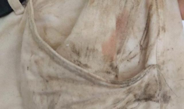 Çankırı'da sevgilisinden ayrılmak isteyen gence öldüresiye dayak