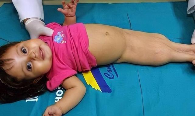 Dünyanın en ilginç hastalıkları