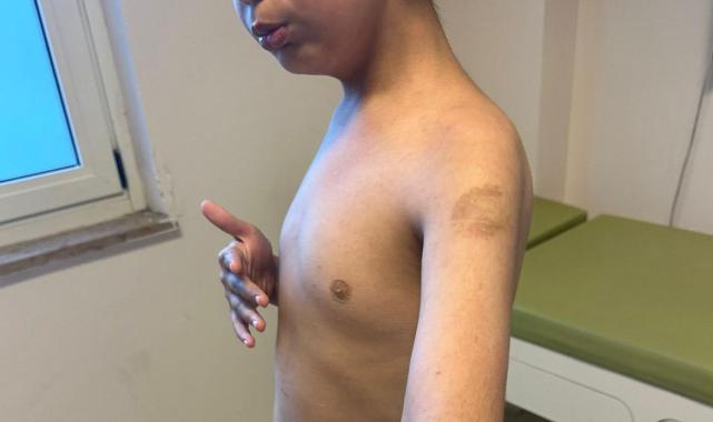 İstanbul, Beylikdüzü'nde özel bakım merkezinde otizmli çocuğa şiddet iddiası