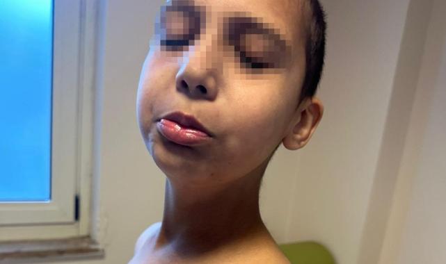 İstanbul, Beylikdüzü'nde özel bakım merkezinde otizmli çocuğa şiddet iddiası