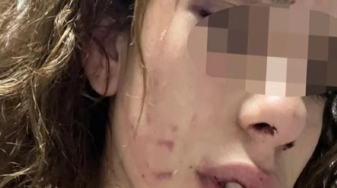 Konya'da 19 yaşındaki kızı darp eden gencin savunması