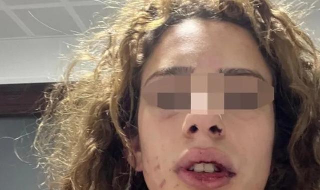 Konya'da kız arkadaşına işkence yaptı serbest kaldı