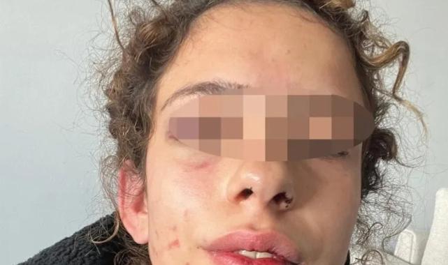 Konya'da kız arkadaşına işkence yaptı serbest kaldı