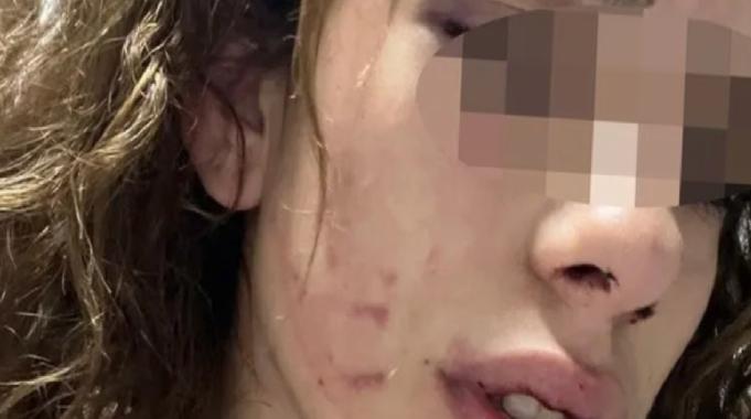 Konya&#039;da kız arkadaşına işkence yaptı serbest kaldı