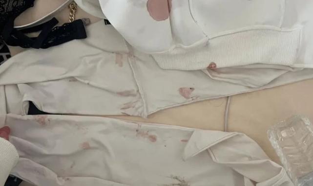 Konya'da kız arkadaşına işkence yaptı serbest kaldı