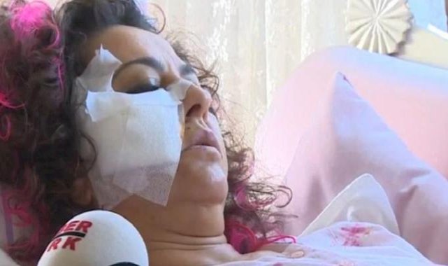 Ankara'da köpeklerin saldırdığı akademisyen: Bu artık insan hakları sorunu